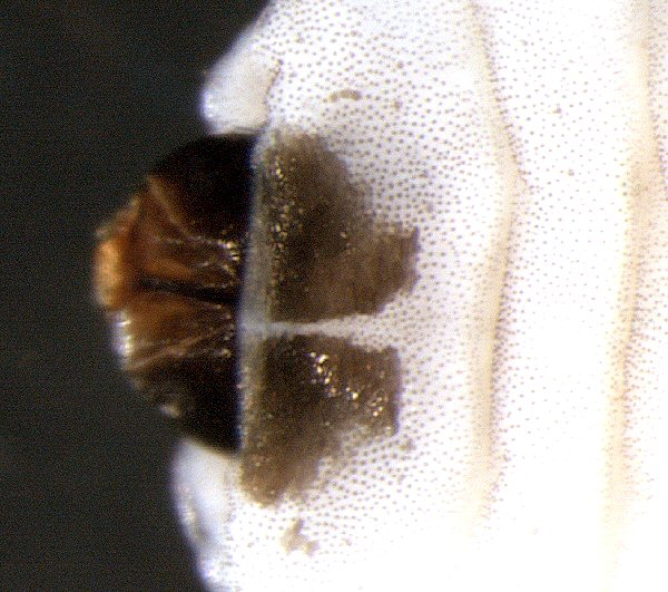 dorsal view