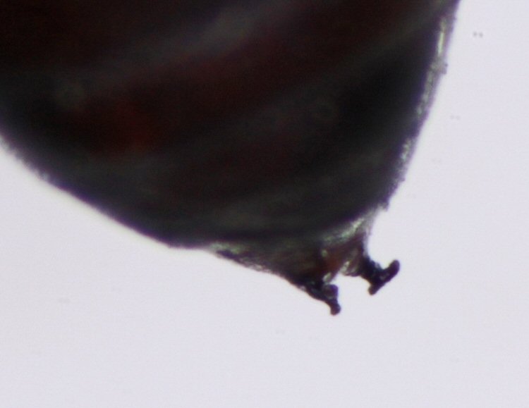 front spiracula